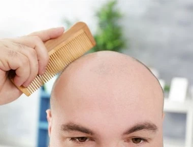 ΗΠΑ: Επιστήμονες ανακάλυψαν τυχαία πιθανή θεραπεία για τη φαλάκρα και το γκριζάρισμα